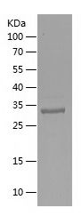    DNA2 / Recombinant Human DNA2