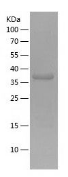    NFATC3 / Recombinant Human NFATC3