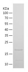    MYLPF / Recombinant Human MYLPF