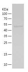    MCRS1 / Recombinant Human MCRS1