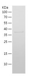    IFITM2 / Recombinant Human IFITM2