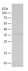    HIST1H1C / Recombinant Human HIST1H1C