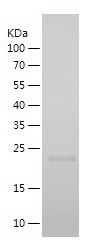    CCNA1 / Recombinant Human CCNA1