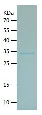    CHRNA7 / Recombinant Human CHRNA7