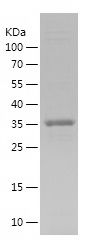    SLC2A3 / Recombinant Human SLC2A3