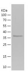    CNDP1 / Recombinant Human CNDP1