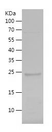    GANP / Recombinant Human GANP