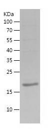    ESR1 / Recombinant Human ESR1