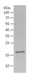    FAM20C / Recombinant Human FAM20C