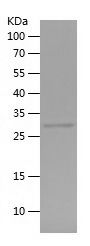    MPC2 / Recombinant Human MPC2