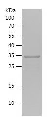    NOP58 / Recombinant Human NOP58