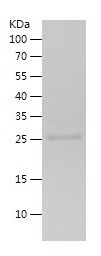    ET-1 / Recombinant Human ET-1