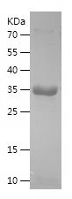    INHBA / Recombinant Human INHBA