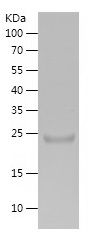    PNLIP / Recombinant Human PNLIP