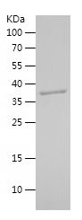    HSP90B1 / Recombinant Human HSP90B1