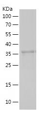    CNN2 / Recombinant Human CNN2