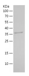    HSDL2 / Recombinant Human HSDL2