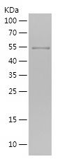    PADI2 / Recombinant Human PADI2