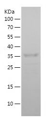    NGB / Recombinant Human NGB