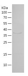    HEY1 / Recombinant Human HEY1