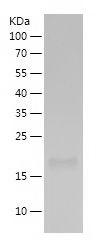    CD95 / Recombinant Human CD95