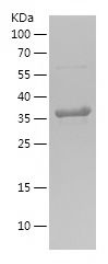    MYH7 / Recombinant Human MYH7