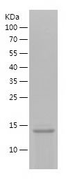    KISS1 / Recombinant Human KISS1