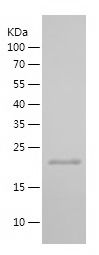    P16-INK4A / Recombinant Human P16-INK4A