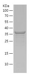    N4BP3 / Recombinant Human N4BP3