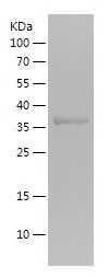    HBG1 / Recombinant Human HBG1