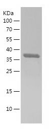    HBS1L / Recombinant Human HBS1L