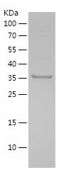    GSTO1 / Recombinant Human GSTO1