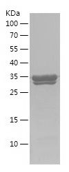    HCN1 / Recombinant Human HCN1