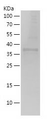    LATS1 / Recombinant Human LATS1