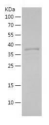    MEF2C / Recombinant Human MEF2C