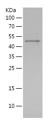    MMP13 / Recombinant Human MMP13