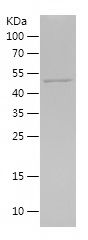    IL11RA / Recombinant Human IL11RA