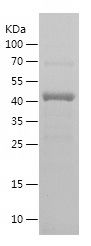    METTL3 / Recombinant Human METTL3