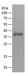    KCND1 / Recombinant Human KCND1