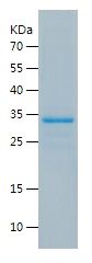    KEAP1 / Recombinant Human KEAP1