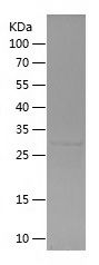    KRT6B / Recombinant Human KRT6B