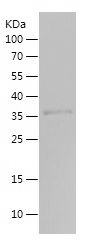    MMP20 / Recombinant Human MMP20