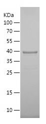    MEF2D / Recombinant Human MEF2D