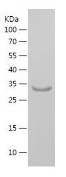    KCNAB2 / Recombinant Human KCNAB2