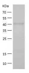    CETP / Recombinant Human CETP