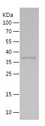    MAP1LC3A / Recombinant Human MAP1LC3A