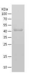    IGF1R / Recombinant Human IGF1R