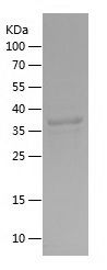    SQSTM1 / Recombinant Human SQSTM1