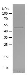    RSK3 / Recombinant Human RSK3