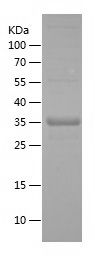    IRF2BP2 / Recombinant Human IRF2BP2